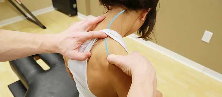 FDM /Fascia Distorziós Modell/ FDM /Fascia Distorziós Modell/